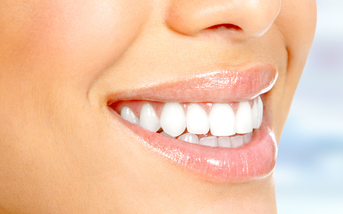 הלבנת שיניים, ד