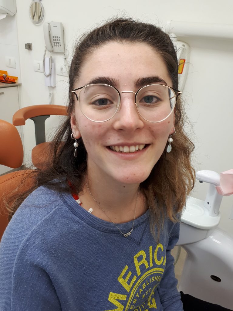 שינוי צורה על של שתי שיניים קדמיות בעזרת קומפוזיט