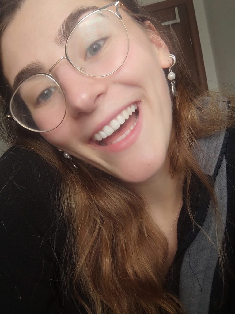 אחרי שינוי צורה על של שתי שיניים קדמיות בעזרת קומפוזיט